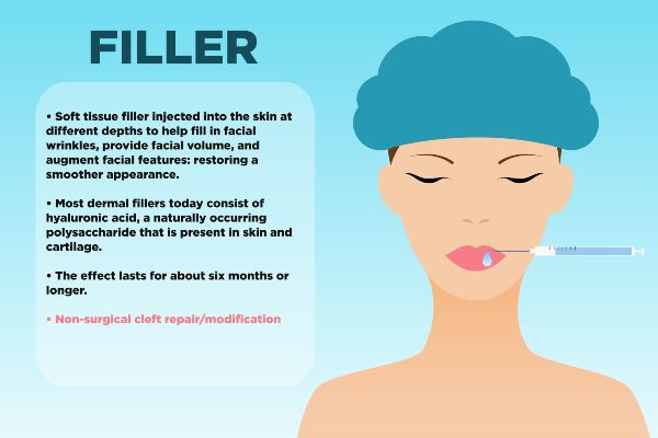 Facial filler information sheet